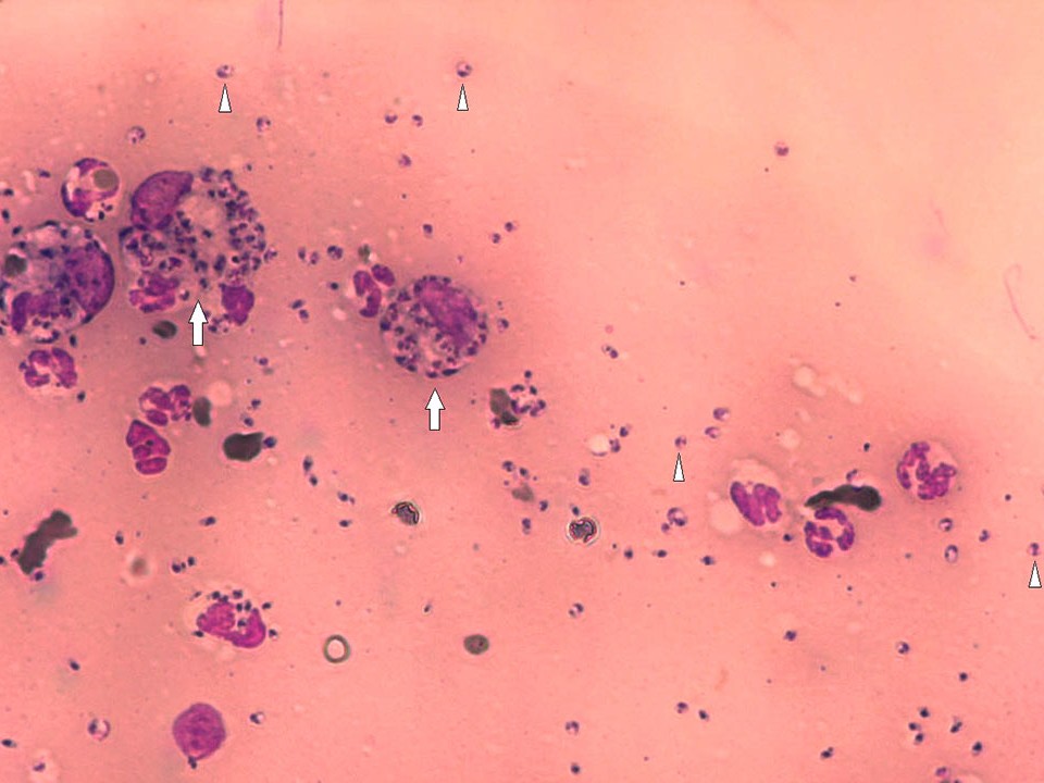 Monitoring and Prognosis